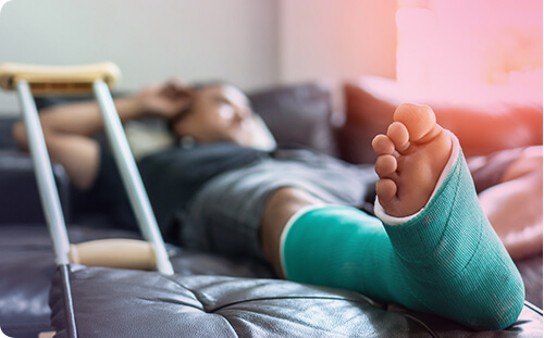 Mann liegt mit Gips auf der Couch